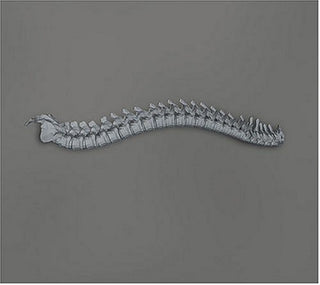 the album cover for Kill Memory Crash - When the Blood Turns Black