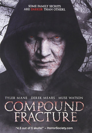 Compound Fracture