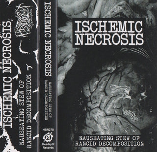 Ischemic Necrosis- Nauseating Stew of Rancid Decomposition